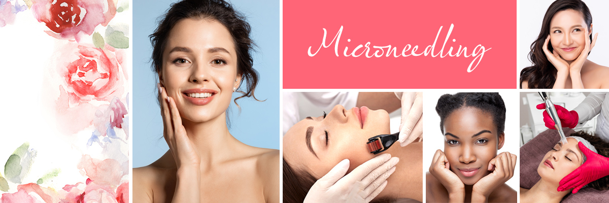 Microneedling Salon Packages at The Salon at Lakeside in Desert Shores